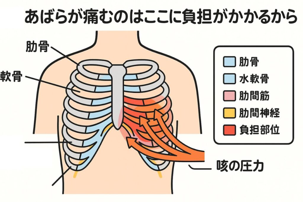 咳のしすぎであばらが痛む仕組みを示す図解