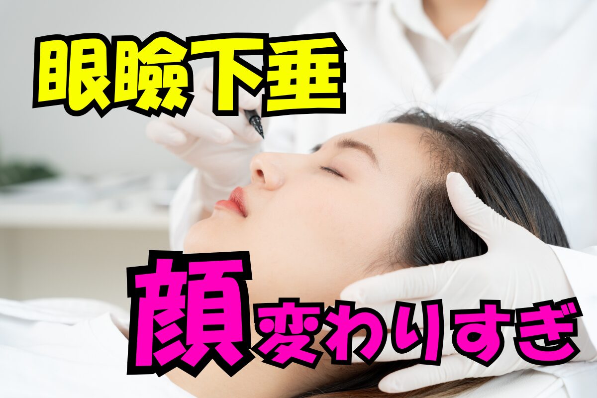 眼瞼下垂によって顔が変わりすぎたことを強調するテキスト入りのイメージ。横たわる女性の顔を医療用手袋をした手で支え、額付近にペン先を当てている様子。